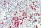 S100A12 / CGRP Antibody (clone 1D1)